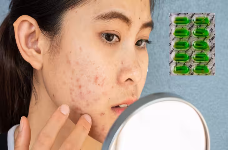 चेहरे पर Vitamin E कैप्सूल लगाने के फायदे और नुकसान: स्किन एक्सपर्ट से समझें इसे लगाने का सही तरीका
