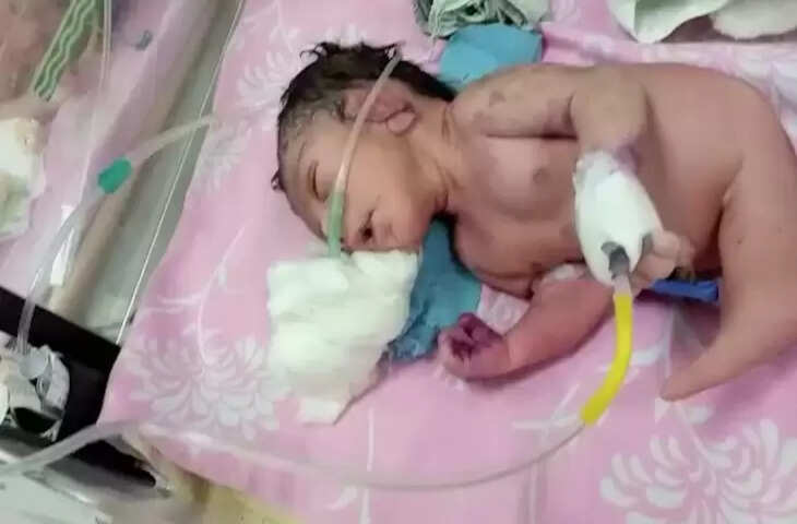 सींग के साथ पैदा हुआ बच्चा, देखकर डॉक्टर के भी उड़ गए  होश, जानिए पूरा मामला !