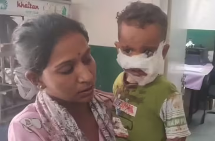 राजस्थान में कुत्तों का कहर! ढाई साल की मासूम का बेरहमी से फाड़ दिया गाल, हर महीने&nbsp;1200 से ज्यादा मामले क्या कर रहा प्रशासन&nbsp;