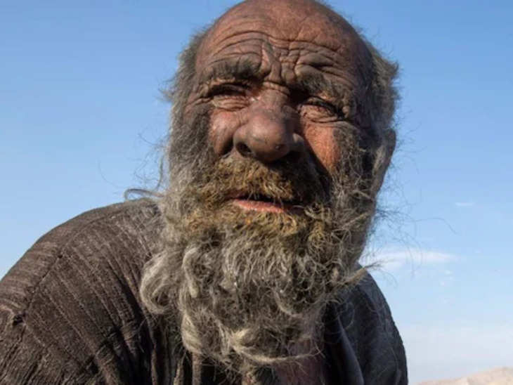 ये था दुनिया का सबसे गंदा इंसान, 67 साल ने नहाया तक नहीं, पहली बार नहाने के बाद हुई मौत !