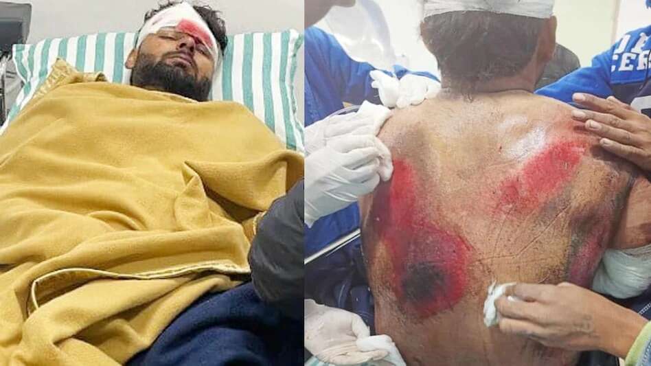 Rishabh Pant Accident: पड़ोसी मुल्क भी कर रहा ऋषभ पंत की सलामती की दुआ... जानें शोएब मलिक ने क्या कहा