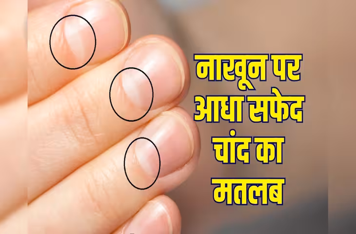 क्या नाखून का आधा चांद खोल सकता है आपकी सेहत का राज? जानें हार्ट, किडनी और शरीर से इसका क्या है कनेक्शन