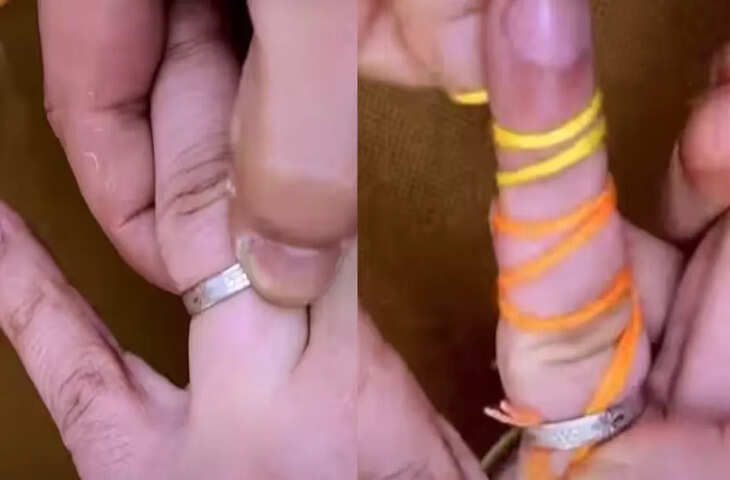 उंगली में फंसी अंगूठी निकालने का देसी जुगाड़, धागे की मदद से अपनाएं ये हैक; खूब वायरल हो रहा Video