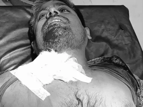 भोजपुर में आभूषण दुकानदार को गोली मारी, गर्दन में लगी गोली से हालत गंभीर