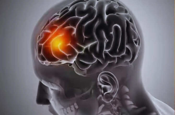 जानिए कौन सी है वो 5 खतरनाक आदतें जो आपके दिमाग को हर दिन कर रही कमजोर, आज से ही करे इन्हें छोड़ने की शुरुआत&nbsp;