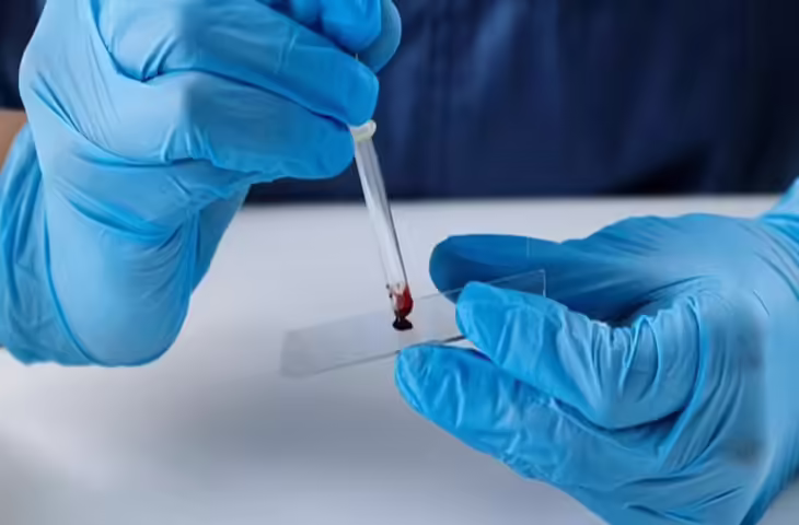 Kochi 'पुलिस ने डीएनए परीक्षण की ओर रुख किया, मारे गए बच्चे के पिता की पहचान के लिए नमूने भेजे