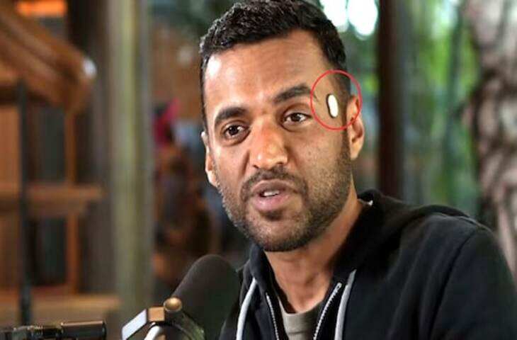 Zomato CEO दीपिंदर गोयल का नया गियर वायरल! क्या है उनकी कनपटी पर लगा ये अनोखा डिवाइस ? और क्या करता है काम&nbsp;