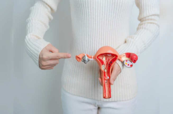 PCOS का नया नाम PMOS? AIIMS डॉक्टर के दावे के बाद चर्चा तेज, जानें क्या है वजह