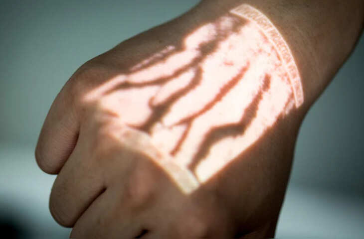 चीन ने बनाई शरीर की नस-नस दिखाने वाली मशीन, इलाज हो जाएगा आसान