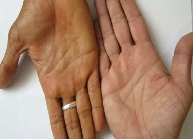 Palmistry reading rajyog sign in palm