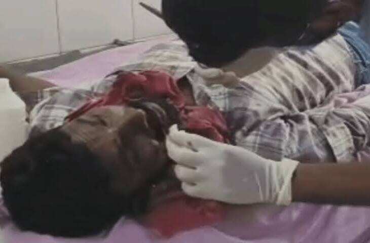 डूंगरपुर में शादी के दौरान बवाल, बारात का रास्ता रोकने पर झड़प; एक्सक्लूसिव फुटेज में देंखे युवक के 6 दांत टूटे