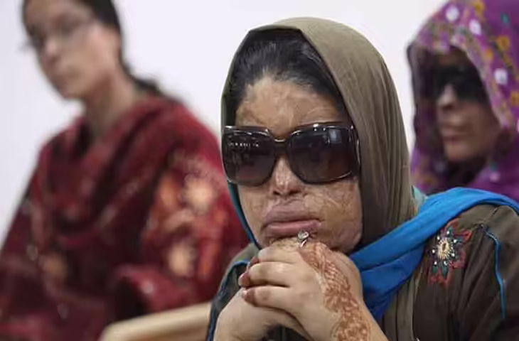 राजस्थान सरकार का बड़ा कदम: एसिड अटैक पीड़ितों को वनपाल पद पर भर्ती का मौका