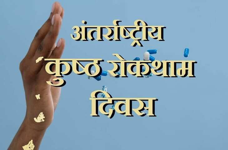 World Leprosy Day 2023 : विश्व कुष्ठ रोग निवारण दिवस कब और क्यों मनाया जाता है ?