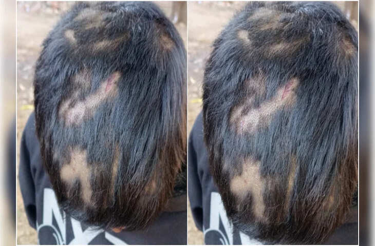 हॉस्टल में सो रहे बच्चे के सिर और भौहों के बाल काटे, पालघर में छात्र के साथ दिल दहला देने वाली वारदात