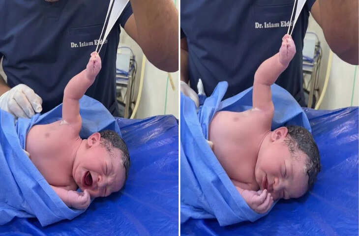 Viral: पैदा होते ही बच्चे का &lsquo;एक्शन मोड ऑन&rsquo; डॉक्टर से ले लिया पंगा, यूजर्स बोले - 'ये तो मिनी बाहुबली है...'&nbsp;