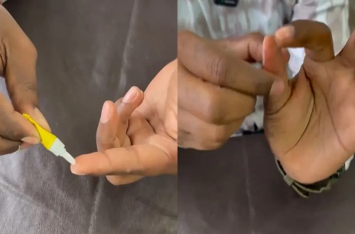 फेवीक्विक से चिपकी उंगली कैसे छुड़ाएं? वीडियो में बताया आसान तरीका